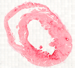 res_pics/rashmi/Cardiomechanobiology figure.jpg